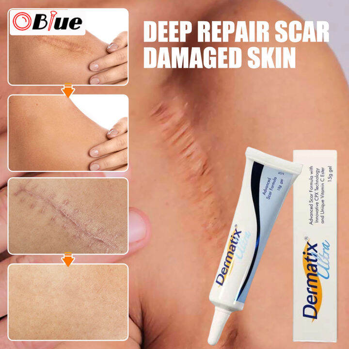 OBlue Scar Repair Gel Surgical Burning Scars Care Lightening Scars Acne