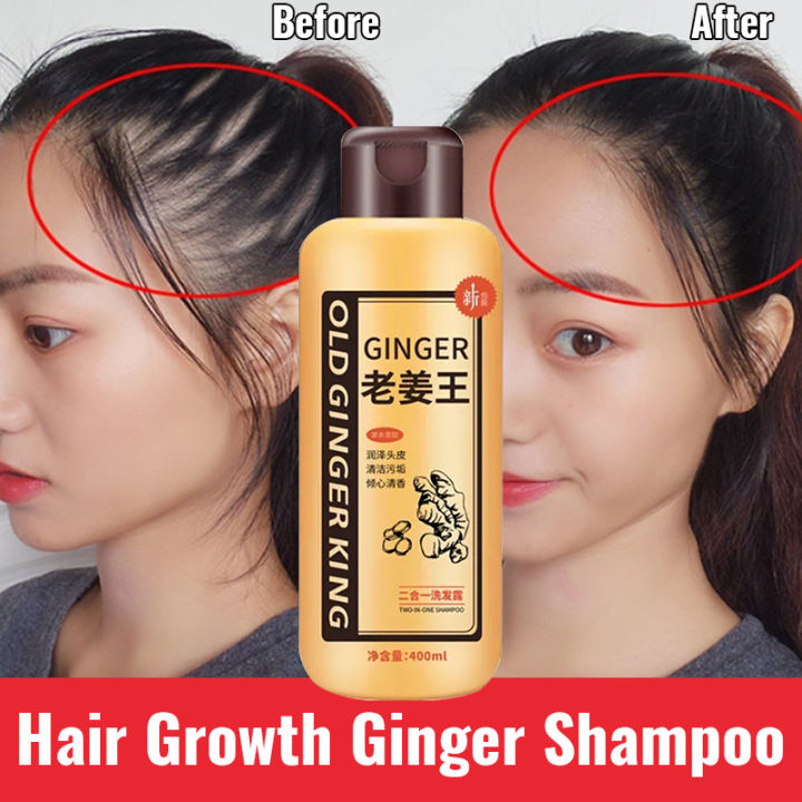 Ginger Hair Shampoo 400ml Fast Regrowth Hair Thick Anti Hair Loss Anti Dandruff Anti Itching