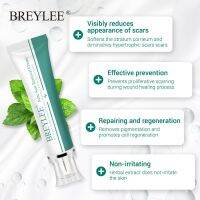 BREYLEE ครีมเจลรอยแผลเป็นรอยฟกช้ำบำรุงผิวยืดได้30G ดูแลผิวเก่าและใหม่ครีมแต้มสิวรอยแผลเป็น