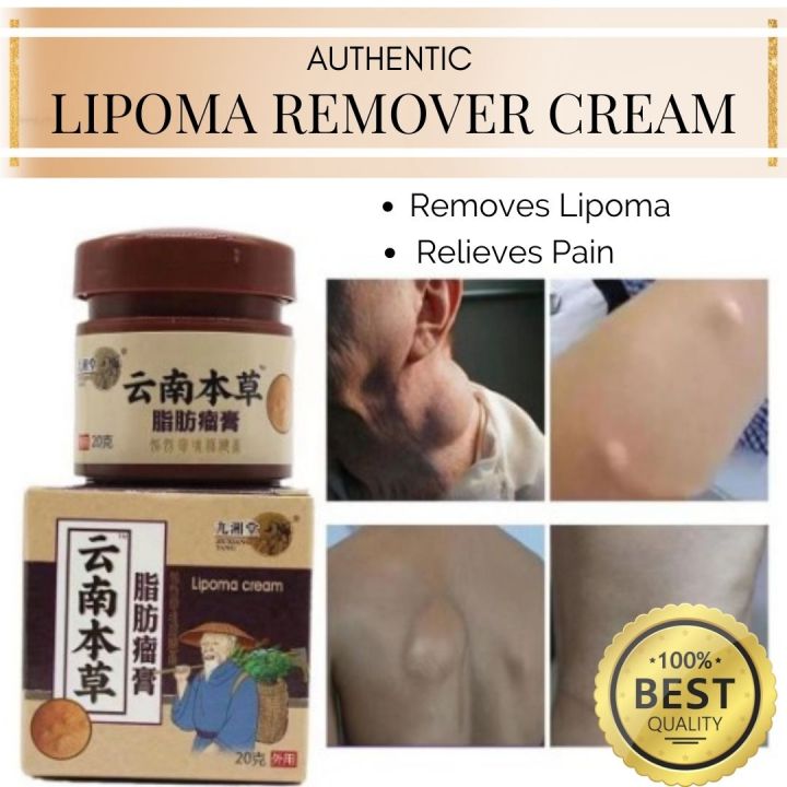 20g Lipoma Remover Ointment Cream Treat Tumor Skin Swelling Ointment ...