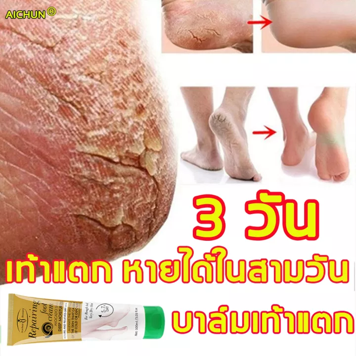 aichun-ครีมส้นเท้าแตก100ml-ครีมส้นเท้าแตก-100ml-เหมาะสำหรับส้นเท้าแตก-ผิวแตก-บำรุงผิว-ครีมสันเท้าแตก-ครีมทาเท้าขาว-ครีม