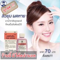 เฟชโลชั่น (FACE LOTION) วิทยาศรม โลชั่นทาสิว ลดสิวผด สิวอักเสบ ยาน้ำถูกและดีที่คนเป็นสิวควรรู้จัก