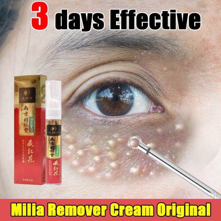 Eye Cream Original 20ml dark circles bag remover butlig sa mata remover Eliminate Milia Remover