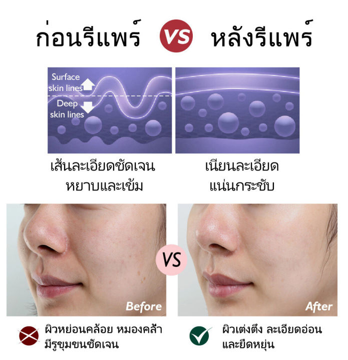 เรตินอลครีม-retinol-cream-ครีมทาผิวขาว-ครีมลดริ้วรอย-ครีมต่อต้านวัย-ครีมบำรุงหน้า-กระชับผิวหน้าให้เต่งตึง-เพิ่มความเรียบเนียนและเปล่งประกายให้แก่ผิว-หน้าเรียบเนียน