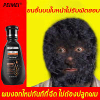 【มีสินค้าพร้อมจัดส่ง】PEIMEI แชมพูสมุนไพร แชมพูแก้ผมร่วง แชมพูขิง 250ml สูตรเข้มข้นพิเศษ สกัดจากขิงสด ซ่อมแซมผมเสีย（เร่งผมเกิดใหม่ ยาสระผมเร่งยาว ป้องกันผมล่วง แชมพูขิงเพียว แชมพูสระผม แชมพูสระผมตรง แชมพูเร่งผมยาว แชมพูลดผมร่วง แชมพูขจัดรังแค）