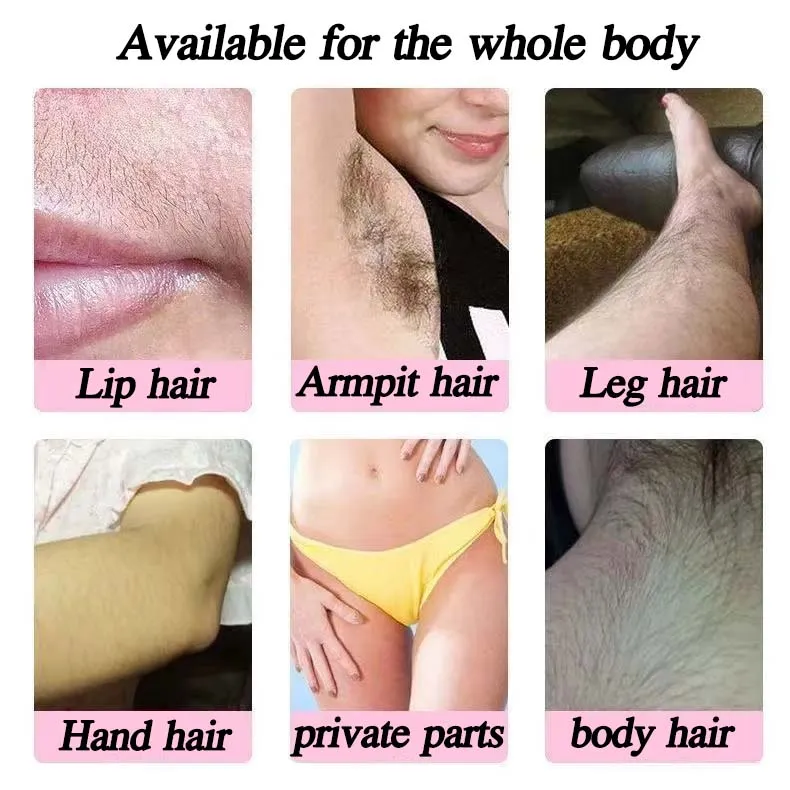 Human body Laser hair removal Laser hair removal Body hair, Esthetic, girl,  arm png | PNGEgg