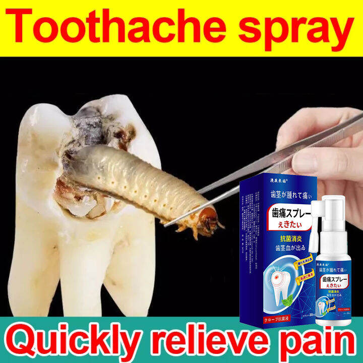 【3 Seconds Pain Relief】Toothache Spray 20ml Fast Pain Relief Plant