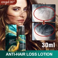 Shop Angels Hair Grower Spray with great discounts and prices online - Feb  2023 | Lazada Philippines