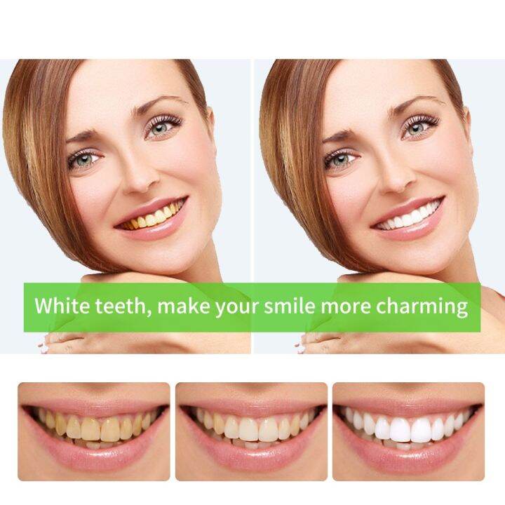 LANBENA Teeth Whitening Pen Lemon Lime Hygiene Gel Effective Remove Stains Cleaning Bleaching