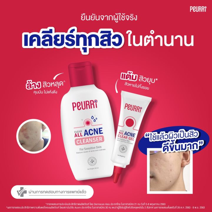 peurri-clear-all-acne-cleanser-เจลล้างหน้า-เพียวรี-แอคเน่-คลีนเซอร์-100-ml