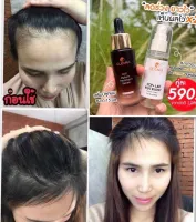 (เซ็ท2ชิ้น)เซรั่มปลูกผม+สเปรย์บำรุงผม Cleara Serum เคลียร่า เซรั่มปลูกผมลดผมร่วง กระตุ้นผมใหม่ เซรั่มปลูกคิ้ว ผมแข็งแรง เส้นผมแข็งแรงส่งฟรี