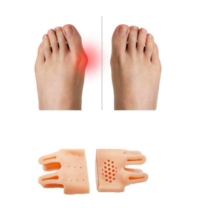 Toe Separators to Correct Your Toes and Relieve Pain , Bunion Corrector