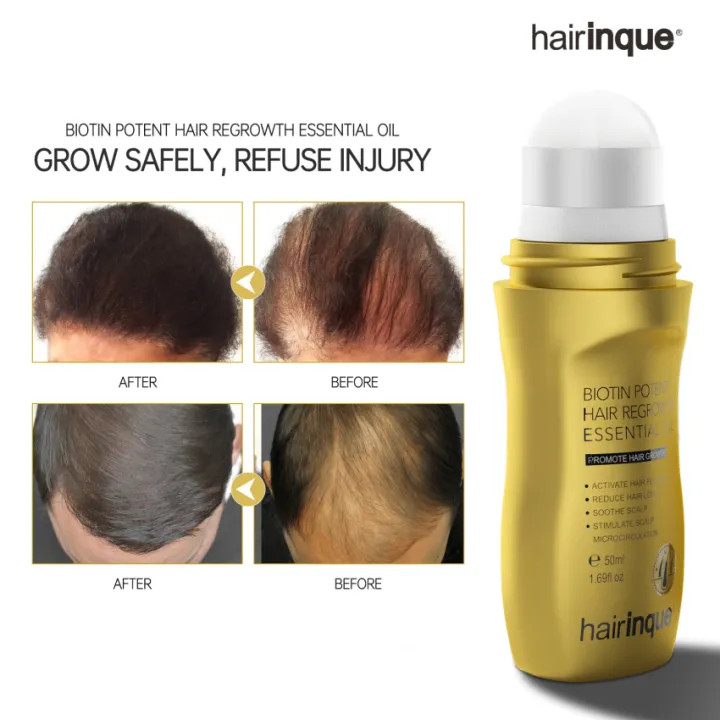 Vitamin B7 Hair Growth Oil Prevent Hair Loss Serum Scalp Treatments