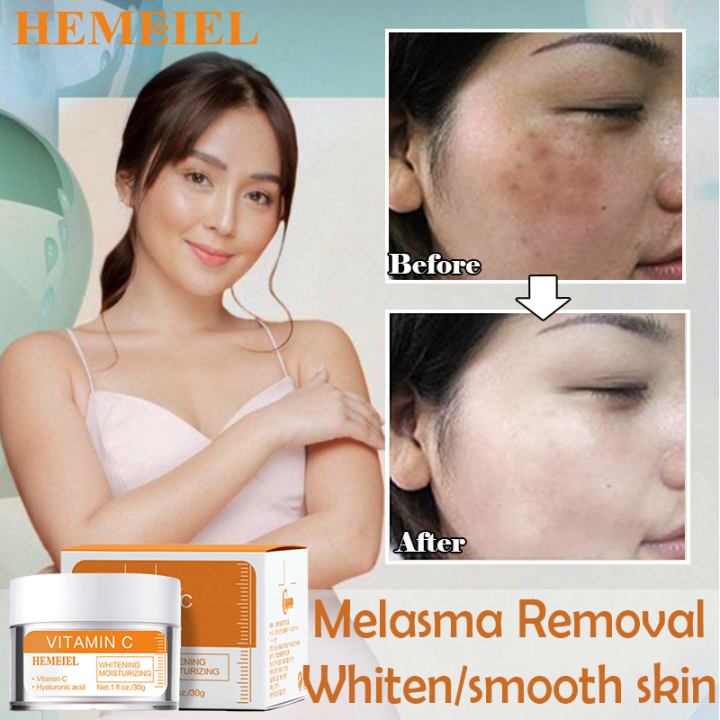 HEMEIEL Vitamins C Syrum/Cream For Face Whitening Cream/Melasma And