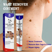 Prettye Genital Wart Herpes Remover ครีมผิว Tags Mole &amp; Papillomas Wart Remover Condyloma Acuminatum Treatment ครีม