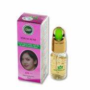 HCMSerum ngừa mụn thâm - Giữ ẩm - Se khít lỗ chân lông Serum Acne SPF+++