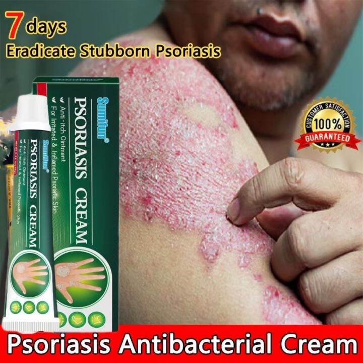 [No side effect] 20g Psoriasis Paste Anti-itch Ointment Rich in Chinese ...