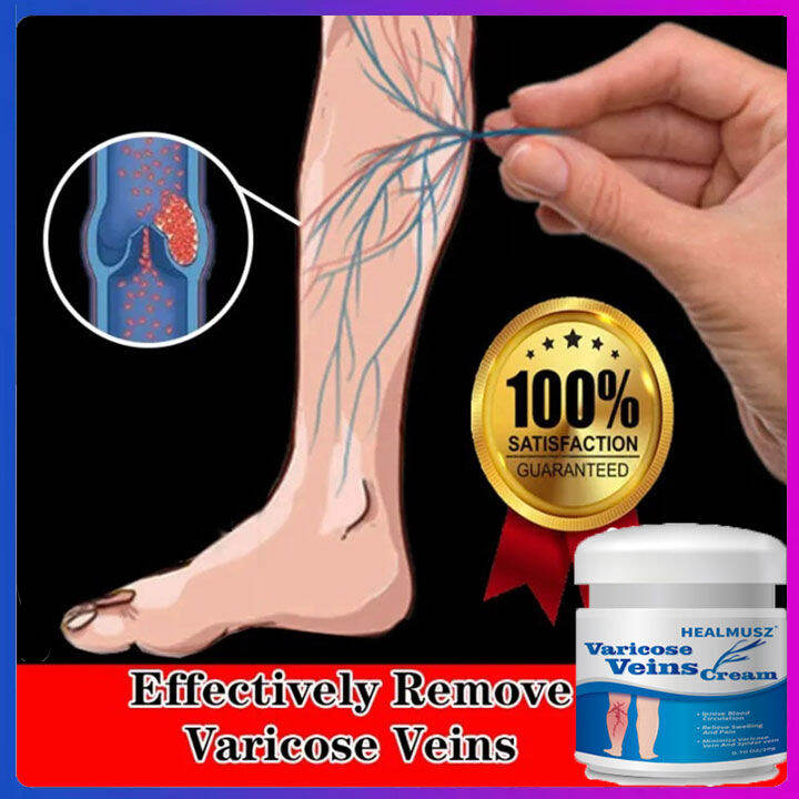 Dearbeauty Varicose Vein Cream 20g Natural Ingredients Effective Anti   3f71699aa86c04423dc31fc30aab2809  720x720q80 