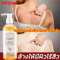 HYQINGเจลอาบน้ำ สบู่อาบน้ำ ครีมอาบน้ำ 260ML ครีมอาบน้ำ โฟมเยอะ อ่อนโยนไม่ระคายเคือง กำจัดไร ล้างให้มีผิวสวยใสไร้สิวออกมา บอกลาผิวหยาบกร้าน ครีมอาบน้ำเด็ก สบู่เหลว เจลอาบน้ำ ครีมอาบน้ำ ครีมอาบน้ำหอมๆ shower gel