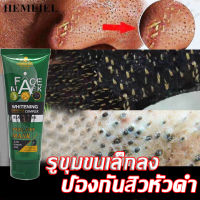 HEMEIEL กำจัดสิวเสี้ยน/ ทำความสะอาดรูขุมขน/มาร์คหน้าลดสิว/ครีมลอกเสี้ยน/แผ่นลอกสิวเสี้ยน