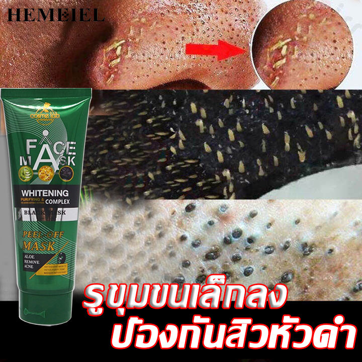 hemeiel-กำจัดสิวเสี้ยน-ทำความสะอาดรูขุมขน-มาร์คหน้าลดสิว-ครีมลอกเสี้ยน-แผ่นลอกสิวเสี้ยน