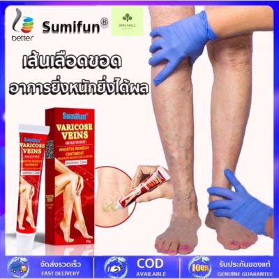 🔥 พร้อมส่งSUMIFUN ครีมทาสำหรับเส้นเลือดขอด ขาสวย ลบเส้นเลือดขอด กลับคืนสุขภาพเท้า