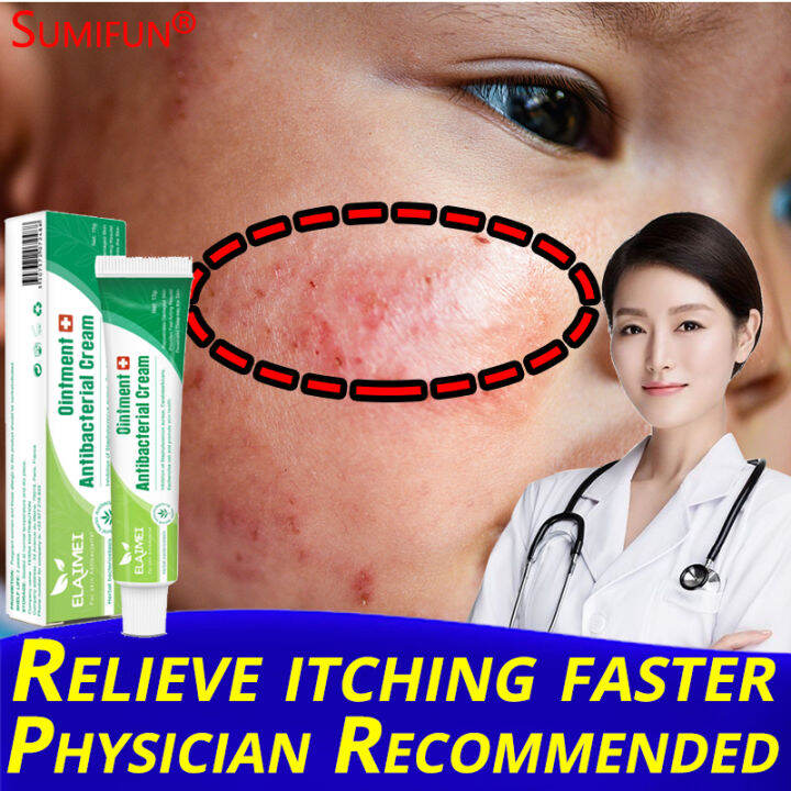 ELAIMEI Psoriasis Ointment herbal antibacterial cream 16g safe all