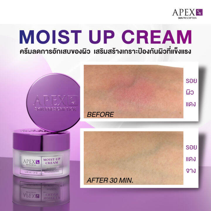 apex-sx-moist-up-cream-ผลิตภัณฑ์ครีมบำรุงผิวหน้าอุดมไปด้วย-moisturizing-มอบความชุ่มชื้นแก่ผิวได้อย่างยาวนาน-120-ชั่วโมง