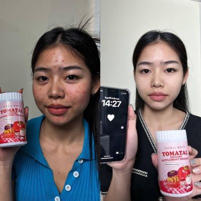 พร้อมส่ง ‼️ กระปุกใหญ่ น้ำชงมะเขือเทศ tomatal ของแท้จากบริษัท📍