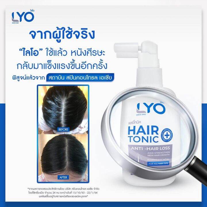 แพ็คคู่-ราคาพิเศษ-lyo-hair-tonic-ไลโอ-แฮร์โทนิค-30-ml-เซรั่มบำรุงผม-ลดผมร่วง-เพิ่มผมหนา-ผมดกดำ