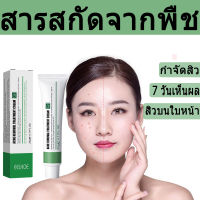 ?%เห็นผลภายใน7วัน EELHOE ครีมกำจัดสิว 20gรอยสิวจางลง ลดรอยสิว ระงับสิวขึ้น รอยสิว บอกลาปัญหาสิว ซ่อมผิวที่ถูกทำลาย คืนผิวสวยกI ลบสิวโดยไม่ทิ้งรอย เจลรักษาสิว ครีมลดรอยสิว ครีมรักษาสิว ครีมลดสิวถาวร เเก้สิว ครีมแต้มสิวยุบ หลุมสิว สิวหายเร่งด่วน