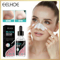 Eelhoe Blackhead ลบเซรั่มจมูก Blackhead Extraction Essence Skin Care Moisturizing ลึกทำความสะอาดรูขุมขนและสิ่งสกปรกที่กำจัดสิวไม่มีตัวปิดจมูกสมุนไพรรูขุมขนหดตัวเซรั่มกระชับผิวเรียบเนียน Care(30Ml)