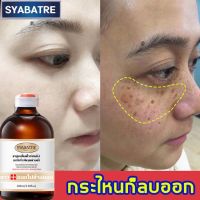 เซรั่มลดฝ้ากระที่ฝังลึก SYABATRE ครีมทาฝ้า 100ml ลดฝ้ากระที่ฝังลึก กำจัดฝ้า จุดด่างดำ ฝ้ากระ กระจ่างใสผิว ครีมทาฝ้าลึก ครีมหน้าขาวใส ครีมทาฝ้ากระ ครีมฝ้ากระ ครีมทาหน้าขาว ครีมกระไวท์เทนนิ่ง ไวท์เทนนิ่งครีม ครีมไวท์เทนนิ่ง บำรุงผิวหน้า ครีมรักษาฝ้า