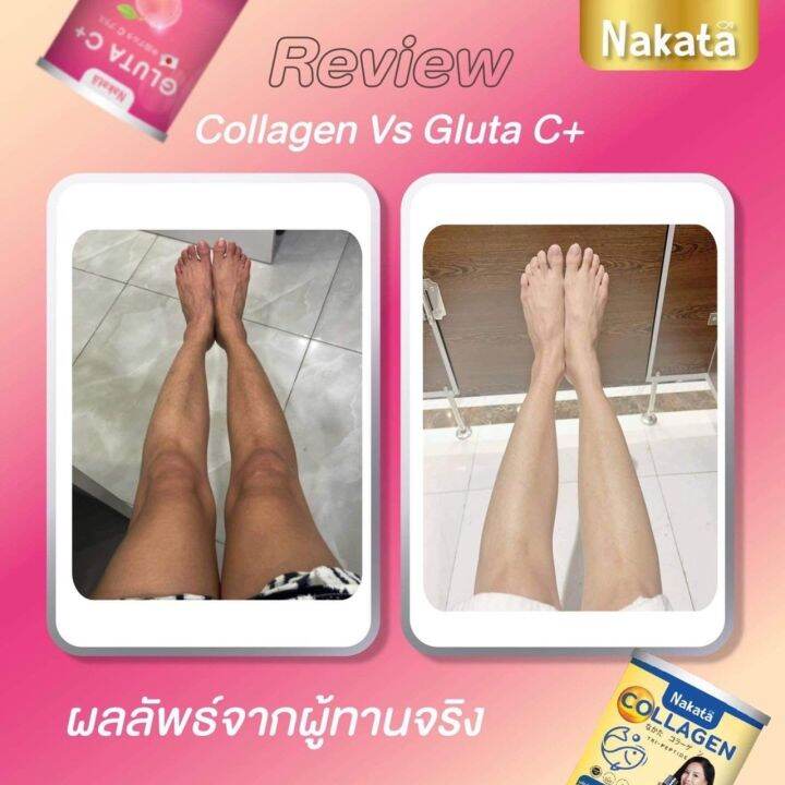 เซ็ทคู่-1แถม1ฟรี-ของแท้-ส่งฟรี-nakata-gluta-c-คอลลาเจล-ผิวสวยครบเซ็ท-กลูต้าซีพลัส-นาคาตะ-ทานง่าย-ไม่คาว-อร่อย-ผิวดี-ออร่า