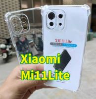 Mi11lite(พร้อมส่งในไทย)เคสใสกันกระแทกคลุมกล้องXiaomi Mi12/Mi12X/Mi11T 5G/Mi11T Pro 5G/Mi11Lite 5G NE/Mi11 Lite 4G/5G