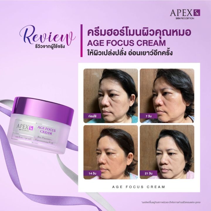 apex-sx-age-focus-cream-ครีมฮอร์โมนผิวสูตรคุณหมอเอเพ็กซ์-ผิวสดใสเปล่งปลั่ง-อ่อนเยาว์อีกครั้ง-30ml