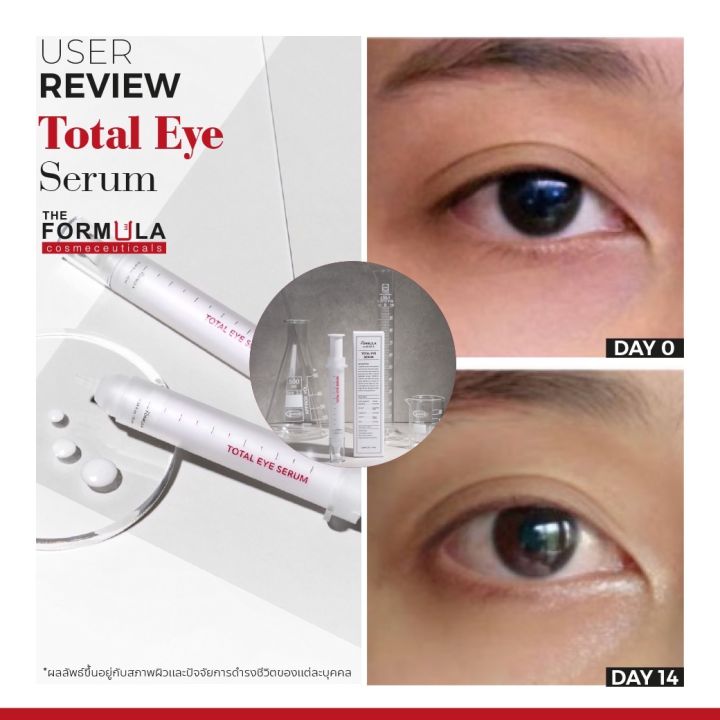 สินค้าขายดีมาก-the-formula-total-eye-serum-10-ml-ครีมทารอบดวงตา-ครีมทาใต้ตา-ลดตาคล้ำถุงใต้ตาและริ้วรอยรอบดวงตา