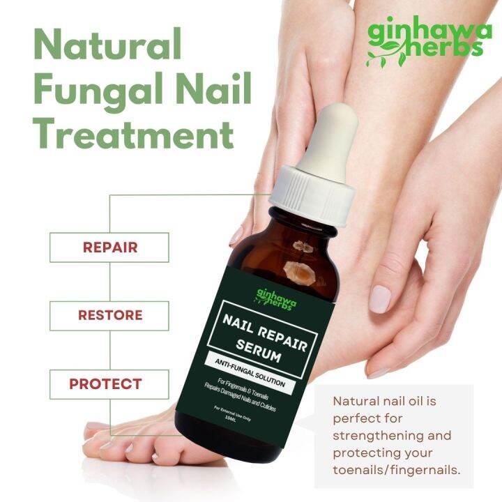 🌟[Ginhawa Herbs] Toenail Fungus Treatment for Toenails and Fingernails