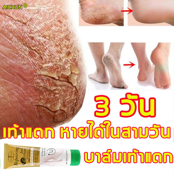 aichun-ครีมทาเท้าแตก-100ml-ครีมบำรุงเท้า-ป้องกันรอยแตกเท้า-ซ่อมแซมส้นเท้าแห้งแตก-แห้ง-หยาบ-หนังแข็ง-ครีมทาส้นทาแตก-ครีมทาส้นเท้าแตก-ส้นเท้าแตก-ครีมทาเท้าขาว-ยาทาส้นเท้าแตก-ครีมส้นเท้าแตก-foot-cacked-h