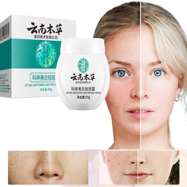 (1PCS) 50g Dr Hancy Yunnan Herbal Whiten and Freckle-Removing Cream ...