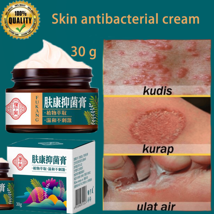 Psoriasis Eczema Cream Antipruritic Antibacterial Cream 30g Herbal