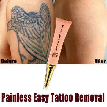 Permanent Tattoo Removal Cream  Best Price in Singapore  Aug 2023   Lazadasg