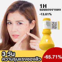 คอลลอยด์กำมะถันออกแบบโดย YOU&amp;PURE เซรั่มฟื้นฟูบำรุงผิว เซรั่มลดสิว กู้ผิวติดสาร ลดฝ้ากระจุดด่างดำ เริมเกราะป้องกันผิวแข็งแรง