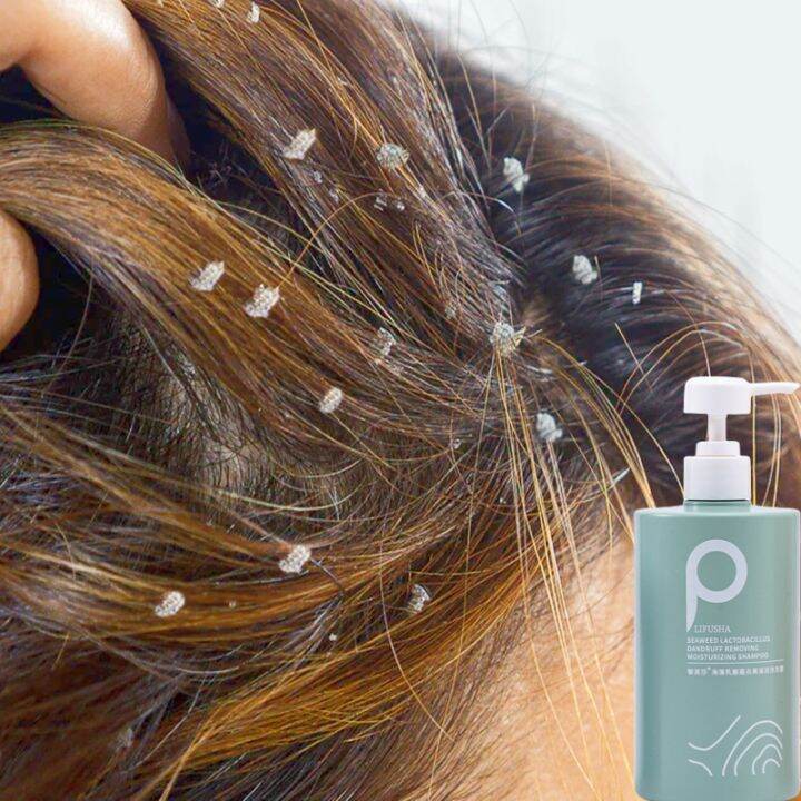 LIFUSHA shampoo kelemumur ubat kulit kepala berkuping syampoo kelemumur