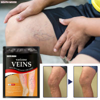 Varicose veins แผ่นแปะเส้นเลือดขอด เส้นเลือดขอด  จะทำให้การอักเสบของหลอดเลือดดำลดลง และทำให้ลิ้นในหลอดเลือดดำกลับมาเป็นปกติได้ ป้องกันหรือลดอาการบวม (แผ่นเปาะเส้นเลือดขอด ครีมแก้เส้นเลือดขอด แปะเส้นเลือดขอด ครีมเส้นเลือดขอ ครีมเสเนเลือดขอด ขาไส้เดือน）