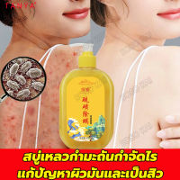 TANYA สบู่เหลวกำมะถันกำจัดไร ครีมอาบน้ำหอมๆ 408ml อุดมไปด้วยกำมะถัน กำจัดไร สิ่งสกปรก ด้วยสารสกัดสมุนไพร กำจัดไรสิวชัดเจน สบู่อาบน้ำครีมอาบน้ำ เจลอาบน้ำกำจัดไร ครีมอาบน้ำเด็ก ครีมอาบน้ำขาว สบู่สูตรลับเฉพาะสบู่เหลว สบู่ผิวขาวถาวร ครีมอาบน้ำลดสิว shower gel