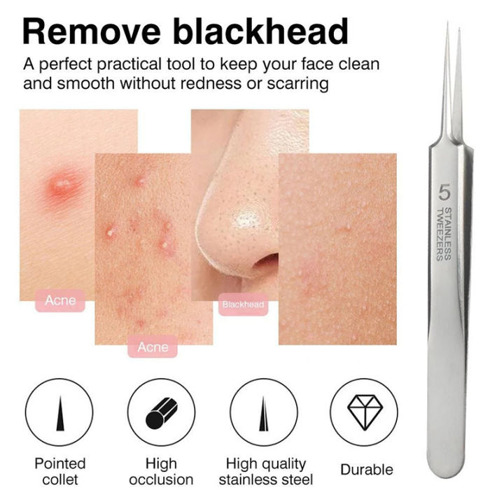 fonix-เข็มกำจัดสิว-ultra-fine-cell-pimples-สแตนเลส-blackhead-คลิปแหนบสิวสิว-remover-เครื่องมือ-skin-care-beauty-treatment-สิว-needl