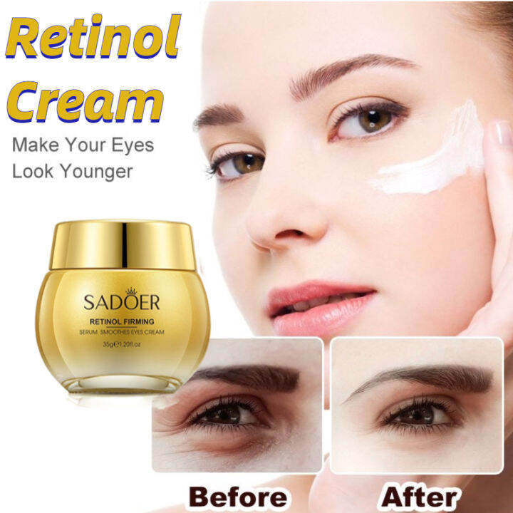 SADOER Retinol Eye Cream Eyebags Remover Cream Eye Care Dark Circles ...