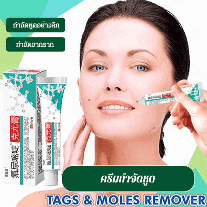 vivilucky Fluorouracil ointment for external application of filiform