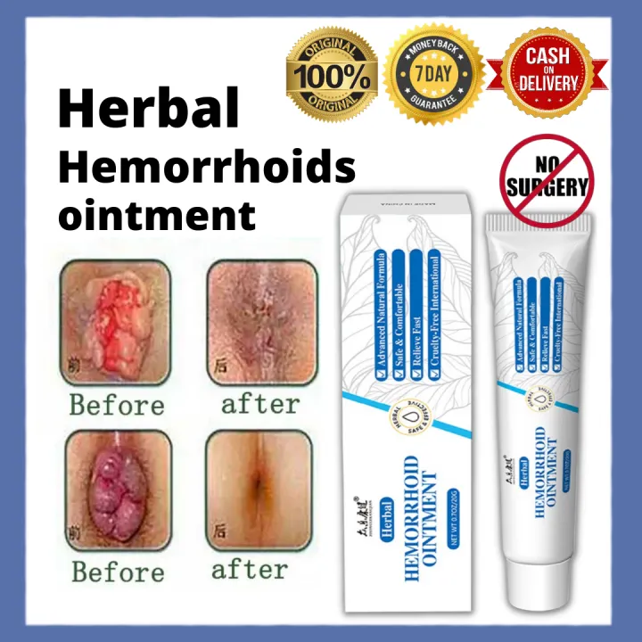 external hemorrhoid with rash